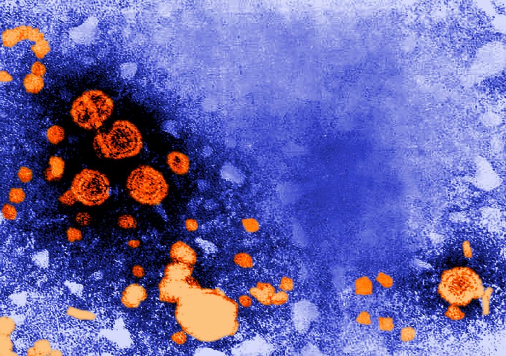 Infeksi Hepatitis B: Gambaran Klinis dan Respons Imunologi